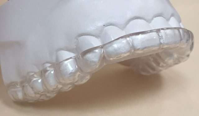 Bruxism Clenching Guards