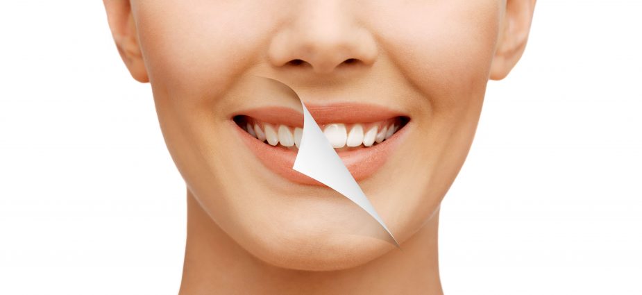 New Smile Min 925x425 1