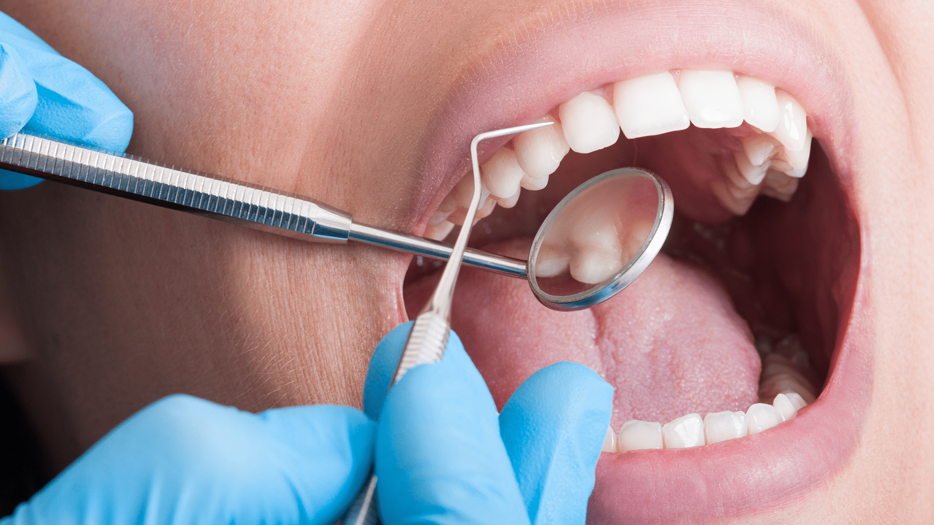 66287a09c094773994f3138e Tooth
