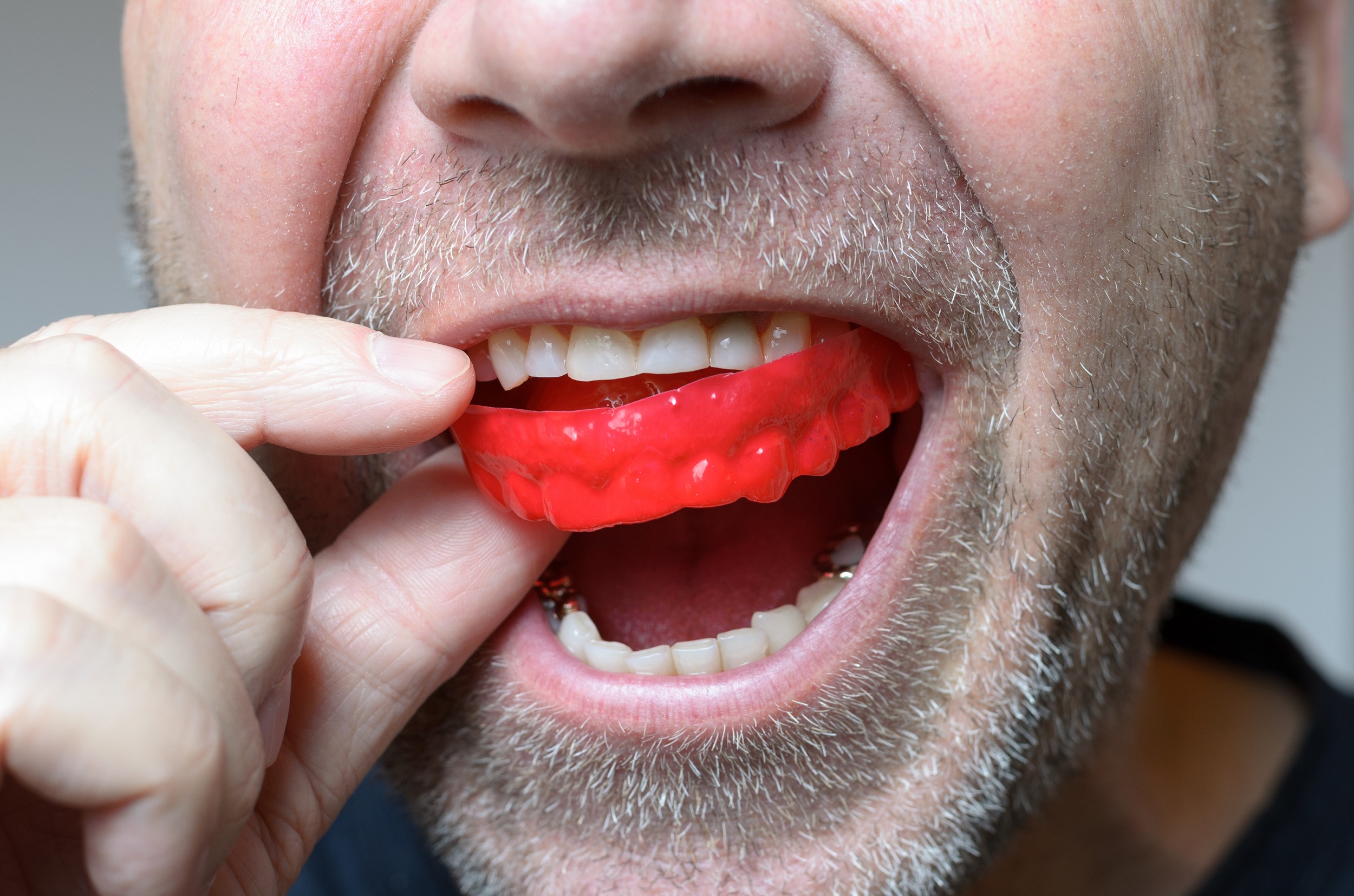 Facts Of About Sports Mouth Guard 1